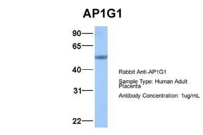 Western Blot: Gamma Adaptin Antibody [NBP1-57633] - Human Adult Placenta, Antibody Dilution: 1.0 ug/ml.