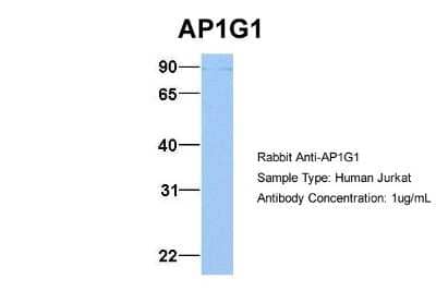 Western Blot: Gamma Adaptin Antibody [NBP1-57633] - Jurkat, Antibody Dilution: 1.0 ug/ml AP1G1 is supported by BioGPS gene expression data to be expressed in Jurkat.