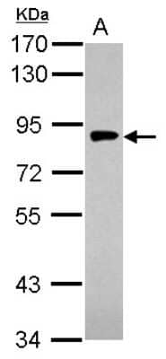 Western Blot: Gamma Adaptin Antibody [NBP2-16599] - Sample (30 ug of whole cell lysate) A: PC-3 7. 5% SDS PAGE gel, diluted at 1:1000.