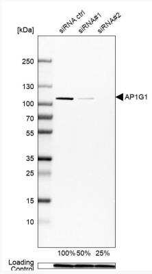 Western Blot: Gamma Adaptin Antibody [NBP2-58947] - Analysis in MCF-7 cells transfected with control siRNA, target specific siRNA probe #1 and #2, using Anti-AP1G1 antibody. Remaining relative intensity is presented. Loading control: Anti-GAPDH.
