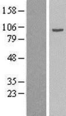 Western Blot Gamma Adaptin Overexpression Lysate