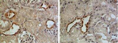 ELISA: Gas6 Antibody (RM0084-6J2) [NBP1-21724] - Rat anti mouse GAS-6