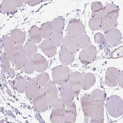 Immunohistochemistry-Paraffin Gasdermin-A Antibody