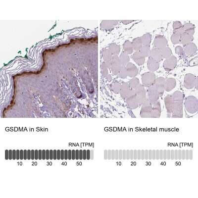 Immunohistochemistry-Paraffin Gasdermin-A Antibody