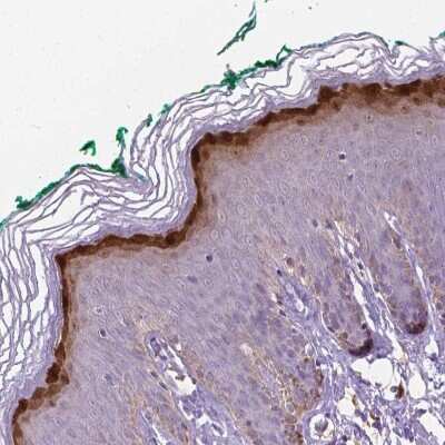 Immunohistochemistry-Paraffin Gasdermin-A Antibody