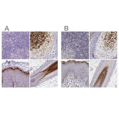 Immunohistochemistry-Paraffin: Gasdermin-A Antibody [NBP2-48564] - Staining of human lymph node, skin, skin and skin, hairy using Anti-GSDMA antibody NBP2-48564 (A) shows similar protein distribution across tissues to independent antibody NBP2-49426 (B).