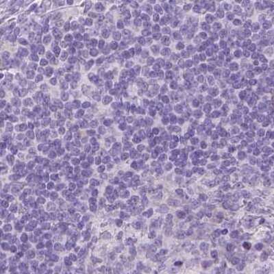 Immunohistochemistry-Paraffin: Gasdermin-A Antibody [NBP2-48564] - Staining of human lymph node.