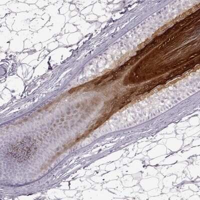 Immunohistochemistry-Paraffin: Gasdermin-A Antibody [NBP2-48564] - Staining of human skin, hairy.