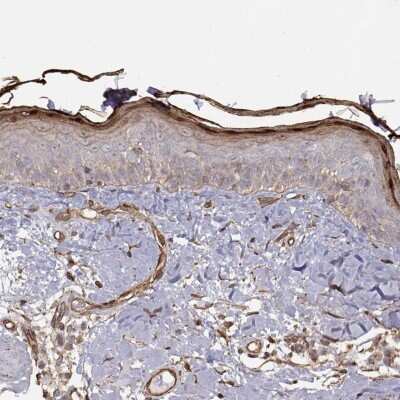 Immunohistochemistry-Paraffin: Gasdermin-A Antibody [NBP2-49426] - Staining of human skin shows high expression.