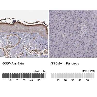 Immunohistochemistry-Paraffin Gasdermin-A Antibody