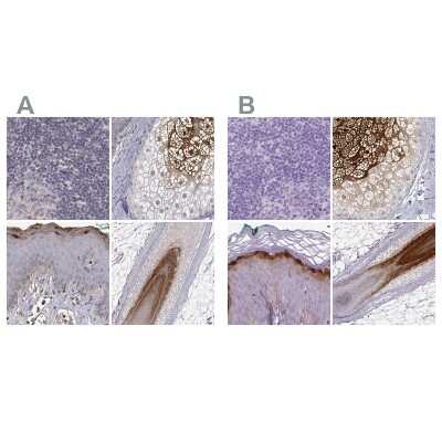 <b>Independent Antibodies Validation and Orthogonal Strategies Validation.</b>Immunohistochemistry-Paraffin: Gasdermin-A Antibody [NBP2-49426] - Staining of human lymph node, skin, skin and skin, hairy using Anti-GSDMA antibody NBP2-49426 (A) shows similar protein distribution across tissues to independent antibody NBP2-48564 (B).