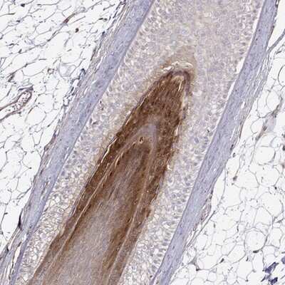 Immunohistochemistry-Paraffin: Gasdermin-A Antibody [NBP2-49426] - Staining of human skin, hairy.