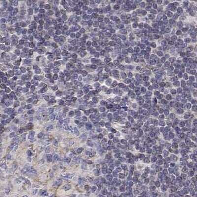 Immunohistochemistry-Paraffin: Gasdermin-A Antibody [NBP2-49426] - Staining of human lymph node.