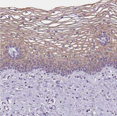 Immunohistochemistry-Paraffin: Gasdermin-C Antibody [NBP1-91926] - Staining of human cervix, uterine shows weak to moderate cytoplasmic positivity in squamous epithelial cells.