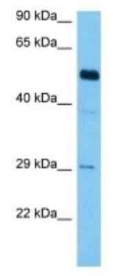 Western Blot: Gasdermin-C Antibody [NBP3-10234] - Western blot analysis of Gasdermin-C in Mouse Lung lysates. Antibody dilution at 1ug/ml