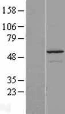 Western Blot: Gasdermin-C Overexpression Lysate (Adult Normal) [NBP2-06131] Left-Empty vector transfected control cell lysate (HEK293 cell lysate); Right -Over-expression Lysate for Gasdermin-C.