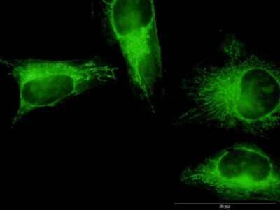 Immunocytochemistry/Immunofluorescence: Gasdermin like Antibody (1E10) [H00055876-M05] - Analysis of monoclonal antibody to GSDMB on HeLa cell. Antibody concentration 20 ug/ml