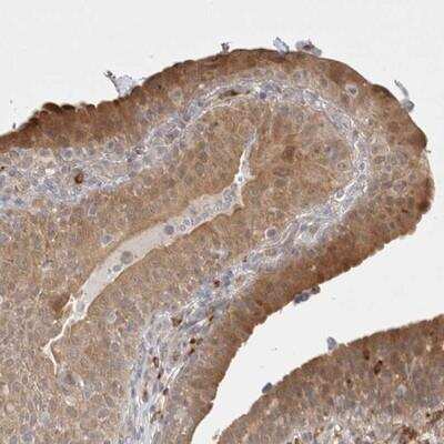 Immunohistochemistry: Gasdermin like Antibody [NBP1-91927] - Staining of human urinary bladder shows strong cytoplasmic positivity in most urothelial cells.