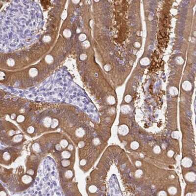 Immunohistochemistry-Paraffin: Gasdermin like Antibody [NBP2-33648] - Staining of human duodenum shows moderate cytoplasmic positivity in glandular cells.