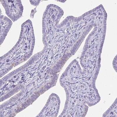 Immunohistochemistry-Paraffin: Gasdermin like Antibody [NBP2-33648] - Staining of human Fallopian tube shows no positivity in glandular cells as expected.