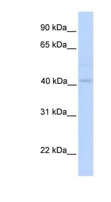 Western Blot: Gasdermin like Antibody [NBP1-54598] - Human Muscle lysate, concentration 0.2-1 ug/ml.