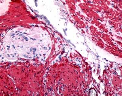 Immunohistochemistry-Paraffin: Gastrin-releasing Peptide/Bombesin/Neuromedin C Antibody [NLS831] - Analysis of anti-GRPR antibody with human colon.