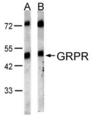 Western Blot: Gastrin-releasing Peptide R/GRPR Antibody [NBP1-30937] - Analysis of GRPR Antibody on HeLa S3 (lane A) and MOLT4 (lane B), diluted at 1:1000 with 10% SDS PAGE gel.