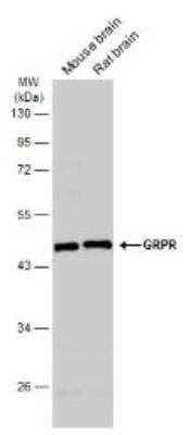 Western Blot: Gastrin-releasing Peptide R/GRPR Antibody [NBP1-30937] - Various tissue extracts (50 ug) were separated by 10% SDS-PAGE, and the membrane was blotted with GRPR antibody [C1C2], Internal (NBP1-30937). The HRP-conjugated anti-rabbit IgG antibody was used to detect the primary antibody.
