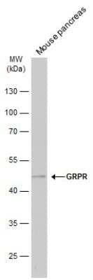 Western Blot: Gastrin-releasing Peptide R/GRPR Antibody [NBP1-30937] - Mouse tissue extract (50 ug) was separated by 10% SDS-PAGE, and the membrane was blotted with GRPR antibody [C1C2], Internal  diluted at 1:1000. The HRP-conjugated anti-rabbit IgG antibody (NBP2-19301) was used to detect the primary antibody.