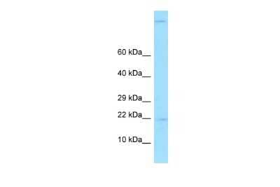 Western Blot: Gastrokine 2 Antibody [NBP2-82885] - WB Suggested Anti-GKN2 Antibody. Titration: 1.0 ug/ml. Positive Control: Fetal Liver