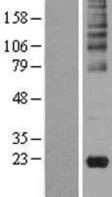 Western Blot: Gastrokine 2 Overexpression Lysate (Adult Normal) [NBL1-11103] Left-Empty vector transfected control cell lysate (HEK293 cell lysate); Right -Over-expression Lysate for Gastrokine 2.