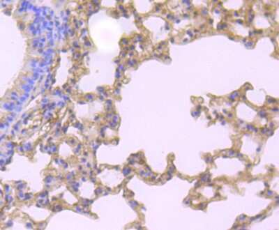 Immunohistochemistry-Paraffin: Gelsolin/GSN Antibody (JB36-68) [NBP2-75503] - Analysis of paraffin-embedded mouse lung tissue using anti-Gelsolin antibody. Counter stained with hematoxylin.