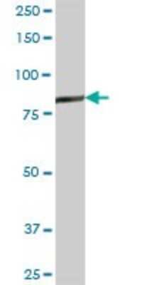 Western Blot: Gelsolin/GSN Antibody [H00002934-B01P] - Analysis of GSN expression in human stomach.