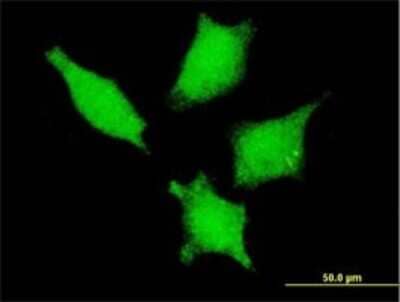 Immunocytochemistry/Immunofluorescence: Gemin 3 Antibody (5H5) [H00011218-M01] - Analysis of monoclonal antibody to DDX20 on HeLa cell . Antibody concentration 10 ug/ml.