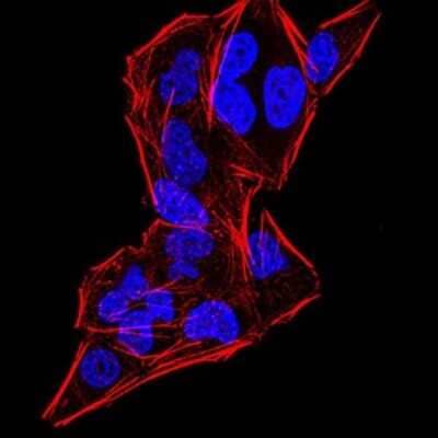 Immunocytochemistry/Immunofluorescence: Gemin 3 Antibody (7B2B1) [NBP2-52453] - Analysis of HeLa cells using DDX20 mouse mAb. Blue: DRAQ5 fluorescent DNA dye. Red: Actin filaments have been labeled with Alexa Fluor- 555 phalloidin.