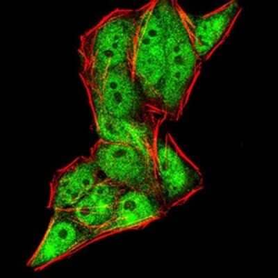 Immunocytochemistry/Immunofluorescence: Gemin 3 Antibody (7B2B1) [NBP2-52453] - Analysis of HeLa cells using DDX20 mouse mAb (green). Red: Actin filaments have been labeled with Alexa Fluor- 555 phalloidin.