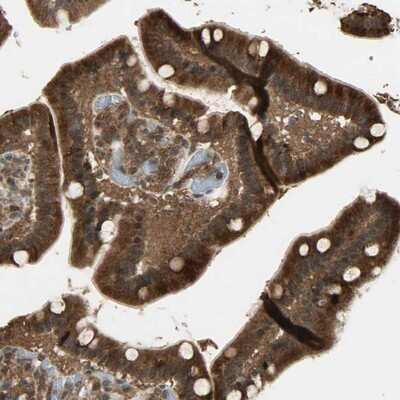 Immunohistochemistry-Paraffin: Gemin 3 Antibody [NBP1-84058] - Staining of human duodenum shows strong cytoplasmic positivity in glandular cells.