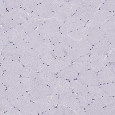 Immunohistochemistry-Paraffin: Gemin 3 Antibody [NBP1-84058] - Staining of human skeletal muscle shows low expression as expected.