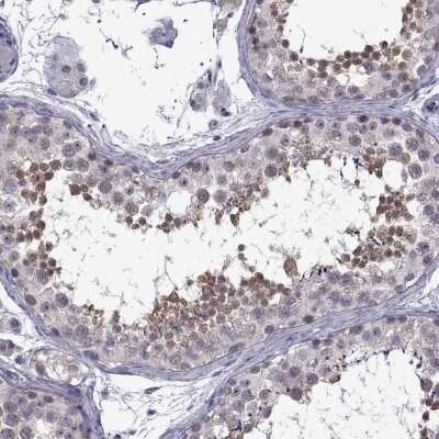 Immunohistochemistry-Paraffin: Gemin 3 Antibody [NBP1-84058] - Staining of human testis shows high expression.