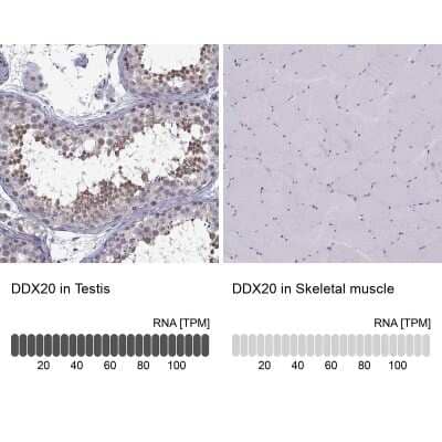 <b>Orthogonal Strategies Validation. </b>Immunohistochemistry-Paraffin: Gemin 3 Antibody [NBP1-84058] - Staining in human testis and skeletal muscle tissues using anti-DDX20 antibody. Corresponding DDX20 RNA-seq data are presented for the same tissues.