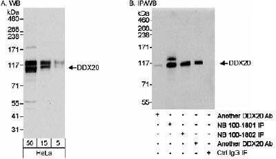 Western Blot: Gemin 3 Antibody [NB100-1801] - Detection of Human DDX20 on HeLa whole cell lystate using NB100-1801. DDX20 was also immunoprecipitated using rabbit anti-DDX20 antibody NB100-1802 and two.