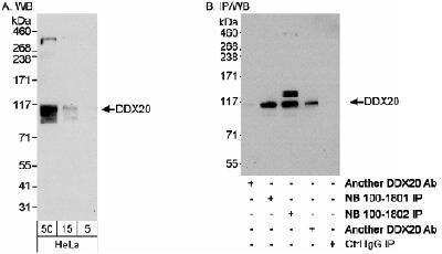 Western Blot: Gemin 3 Antibody [NB100-1802] - Detection of Human DDX20 on HeLa whole cell lystate using NB100-1802. DDX20 was also immunoprecipitated using rabbit anti-DDX20 antibody NB100-1801 and two others.