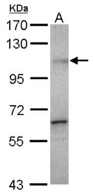 Western Blot: Gemin 3 Antibody [NBP2-16638] - Sample (30 ug of whole cell lysate) A: HeLa 7. 5% SDS PAGE gel, diluted at 1:500.