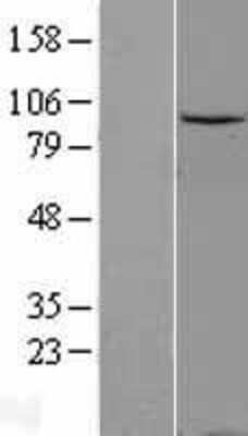 Western Blot: Gemin 3 Overexpression Lysate (Adult Normal) [NBL1-09786] Left-Empty vector transfected control cell lysate (HEK293 cell lysate); Right -Over-expression Lysate for Gemin 3.