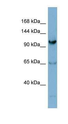 Western Blot: Gemin 4 Antibody [NBP1-52913] - Jurkat cell lysate, concentration 0.2-1 ug/ml.