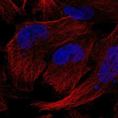 Immunocytochemistry/Immunofluorescence: Gemin 5 Antibody [NBP2-58136] - Staining of human cell line U-251 MG shows no positivity.
