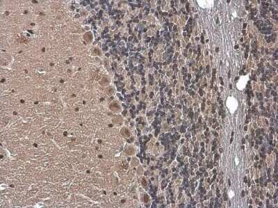 Immunohistochemistry-Paraffin: Gemin 5 Antibody [NBP3-12933] - Gemin 5 antibody detects Gemin 5 protein at cytoplasm and nucleus by immunohistochemical analysis. Sample: Paraffin-embedded mouse brain. Gemin 5 stained by Gemin 5 antibody (NBP3-12933) diluted at 1:500. Antigen Retrieval: Citrate buffer, pH 6.0, 15 min