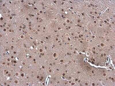 Immunohistochemistry-Paraffin: Gemin 5 Antibody [NBP3-12933] - Gemin 5 antibody detects Gemin 5 protein at cytoplasm and nucleus by immunohistochemical analysis. Sample: Paraffin-embedded mouse brain. Gemin 5 stained by Gemin 5 antibody (NBP3-12933) diluted at 1:500. Antigen Retrieval: Citrate buffer, pH 6.0, 15 min