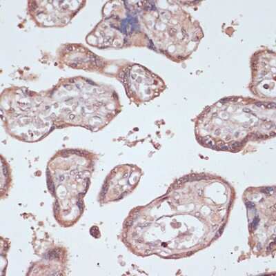 Immunohistochemistry-Paraffin: Gemin 5 Antibody [NBP3-15523] - Immunohistochemistry of paraffin-embedded human placenta using Gemin 5 antibody (NBP3-15523) at dilution of 1:100 (40x lens).Perform microwave antigen retrieval with 10 mM PBS buffer pH 7.2 before commencing with IHC staining protocol.