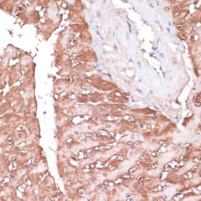 Immunohistochemistry-Paraffin: Gemin 5 Antibody [NBP3-15523] - Immunohistochemistry of paraffin-embedded rat heart using Gemin 5 antibody (NBP3-15523) at dilution of 1:100 (40x lens).Perform microwave antigen retrieval with 10 mM PBS buffer pH 7.2 before commencing with IHC staining protocol.